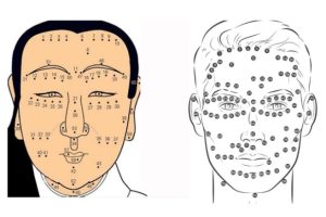 Những vị trí nốt ruồi cảnh báo nguy cơ bệnh lý thường gặp